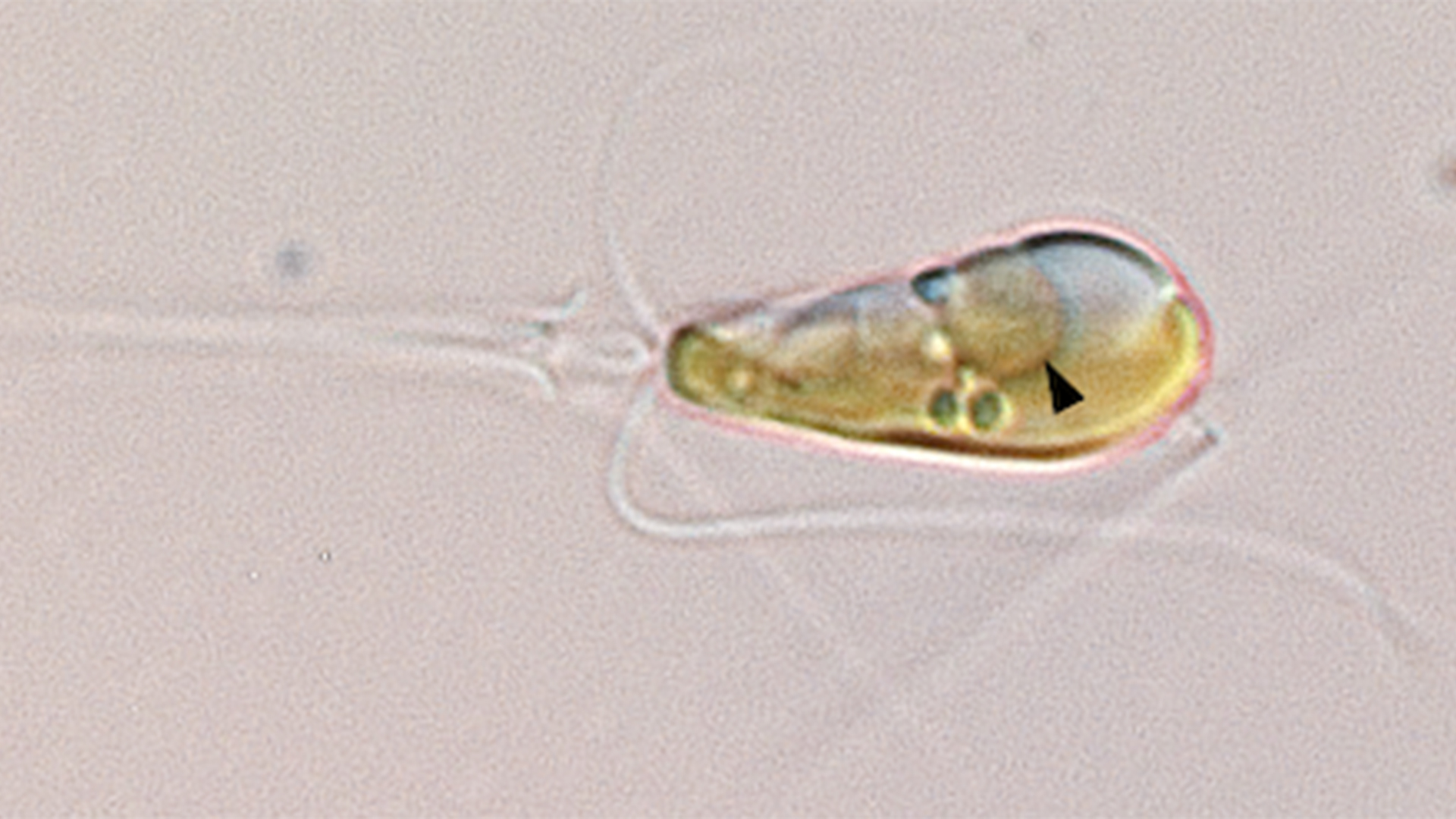 A microscopic image of a oblong, greenish cell with a black arrow pointing to a large circle within it